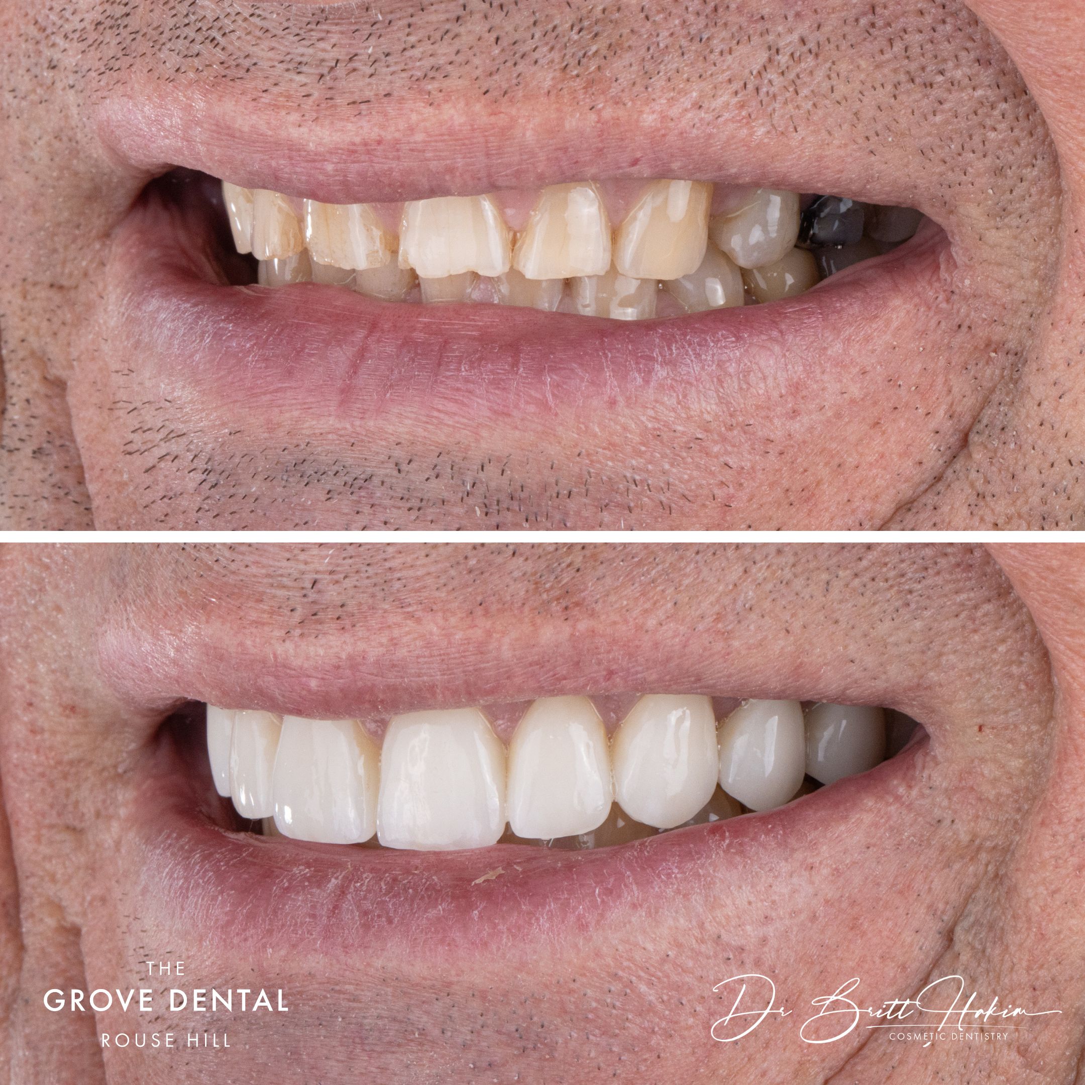 smile makeover rouse hill