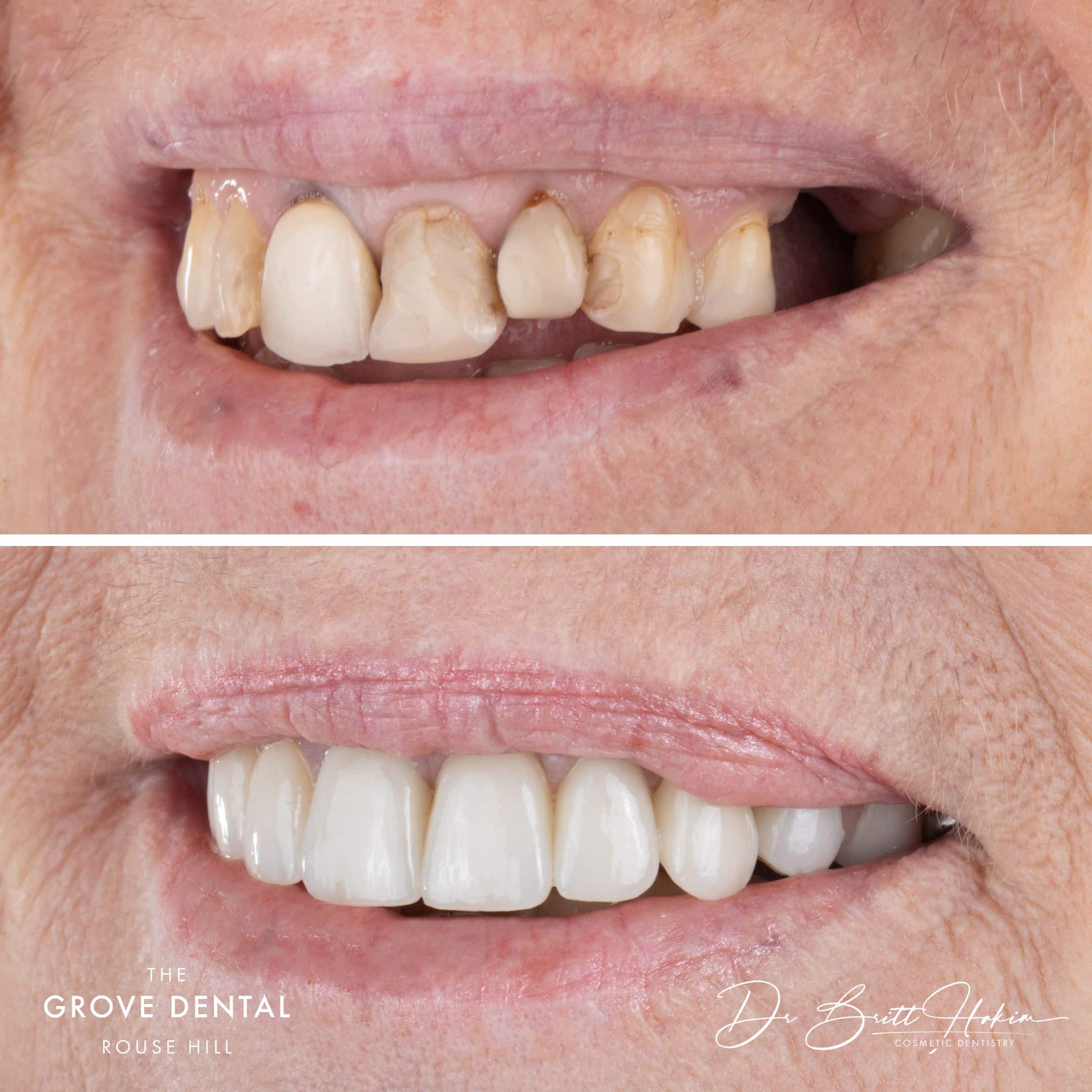 smile makeover north kellyville