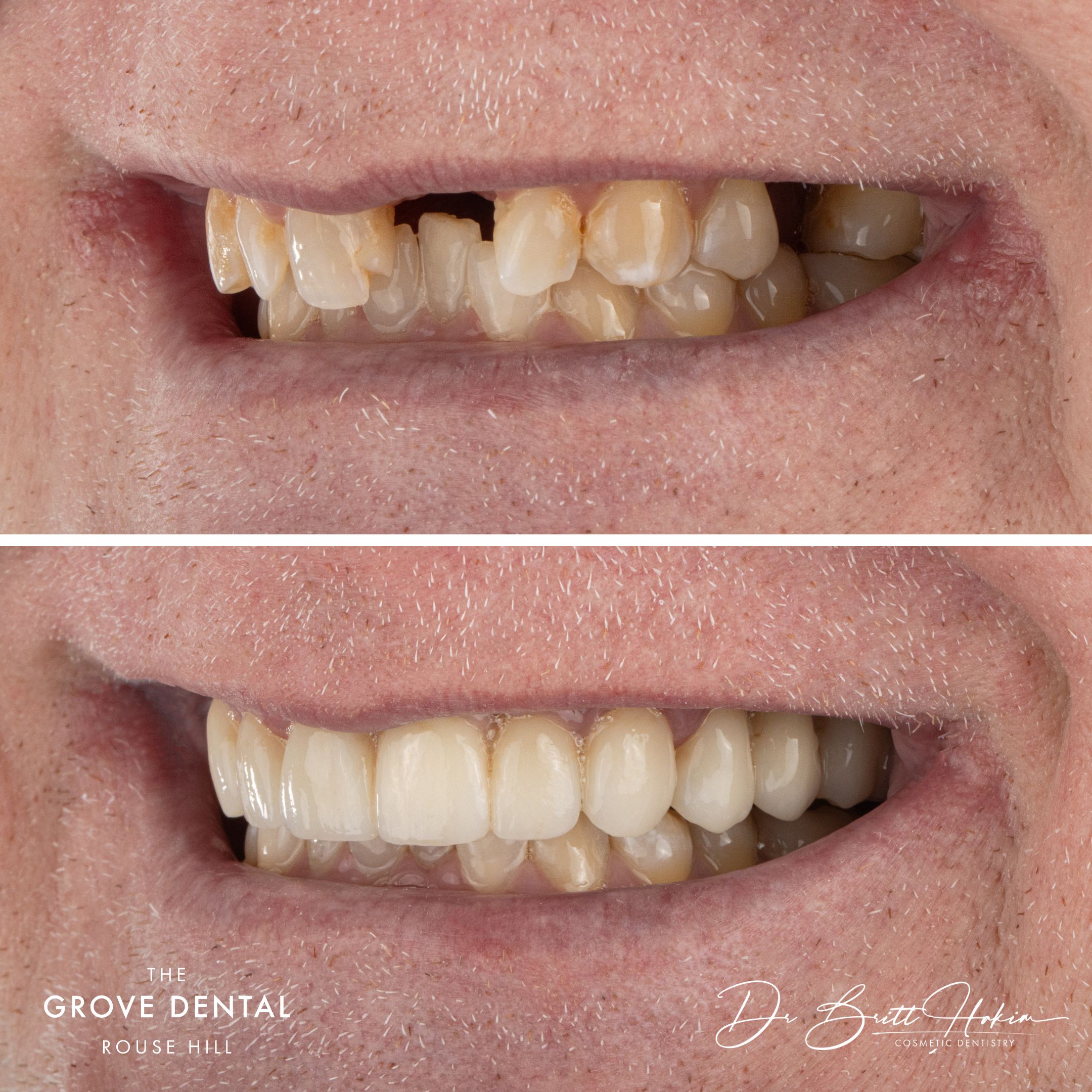 rouse hill smile makeover